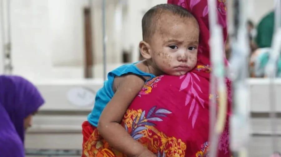 3 more die from suspected measles | Others