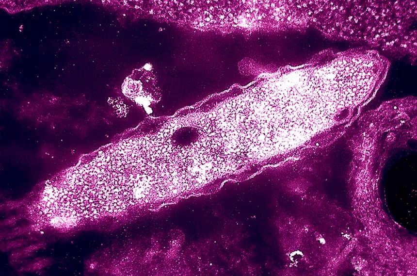 One dead from Legionnaires' disease in New York | News