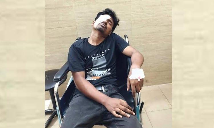 Shuvo loses an eye but not hope, seeks merit-based rehabilitation | Others