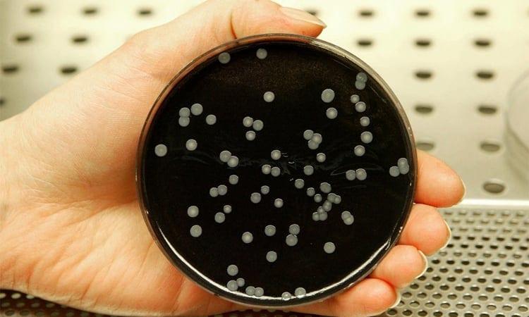 Three dead in Legionnaires' outbreak in Austria | News