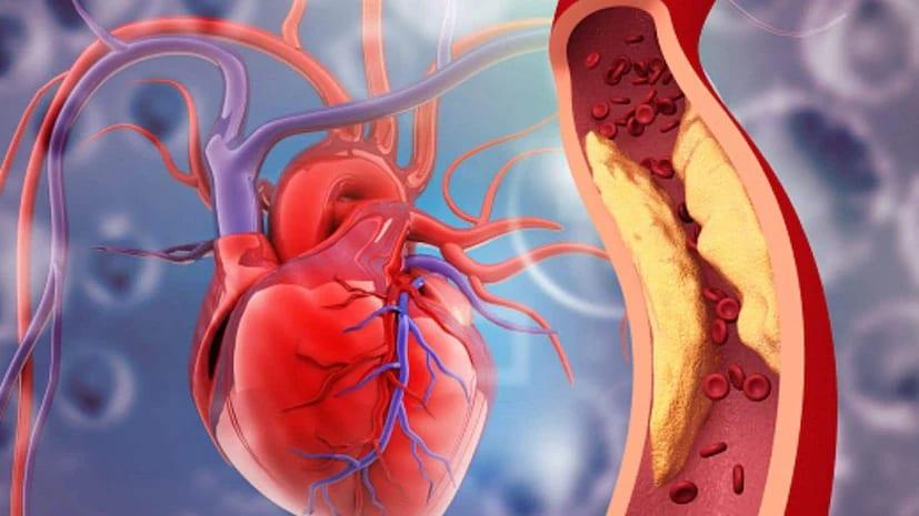 Drug abuse threatens young hearts, fuels rise in early heart attacks | Special Stories